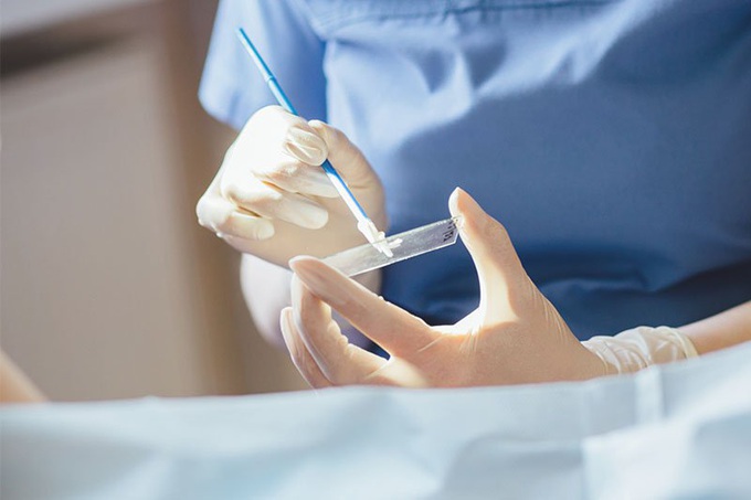 Sẽ đề xuất BHYT trả phí sàng lọc ung thư cổ tử cung